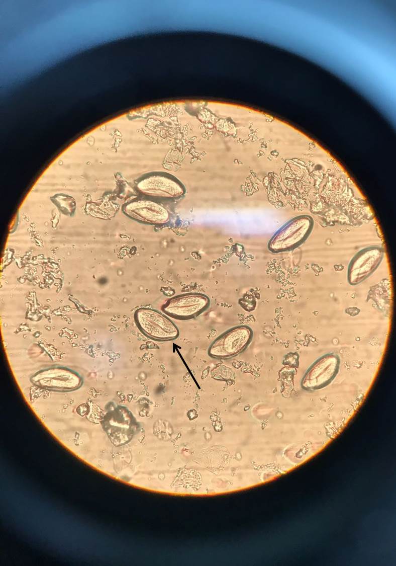 enterobius vermicularis uova